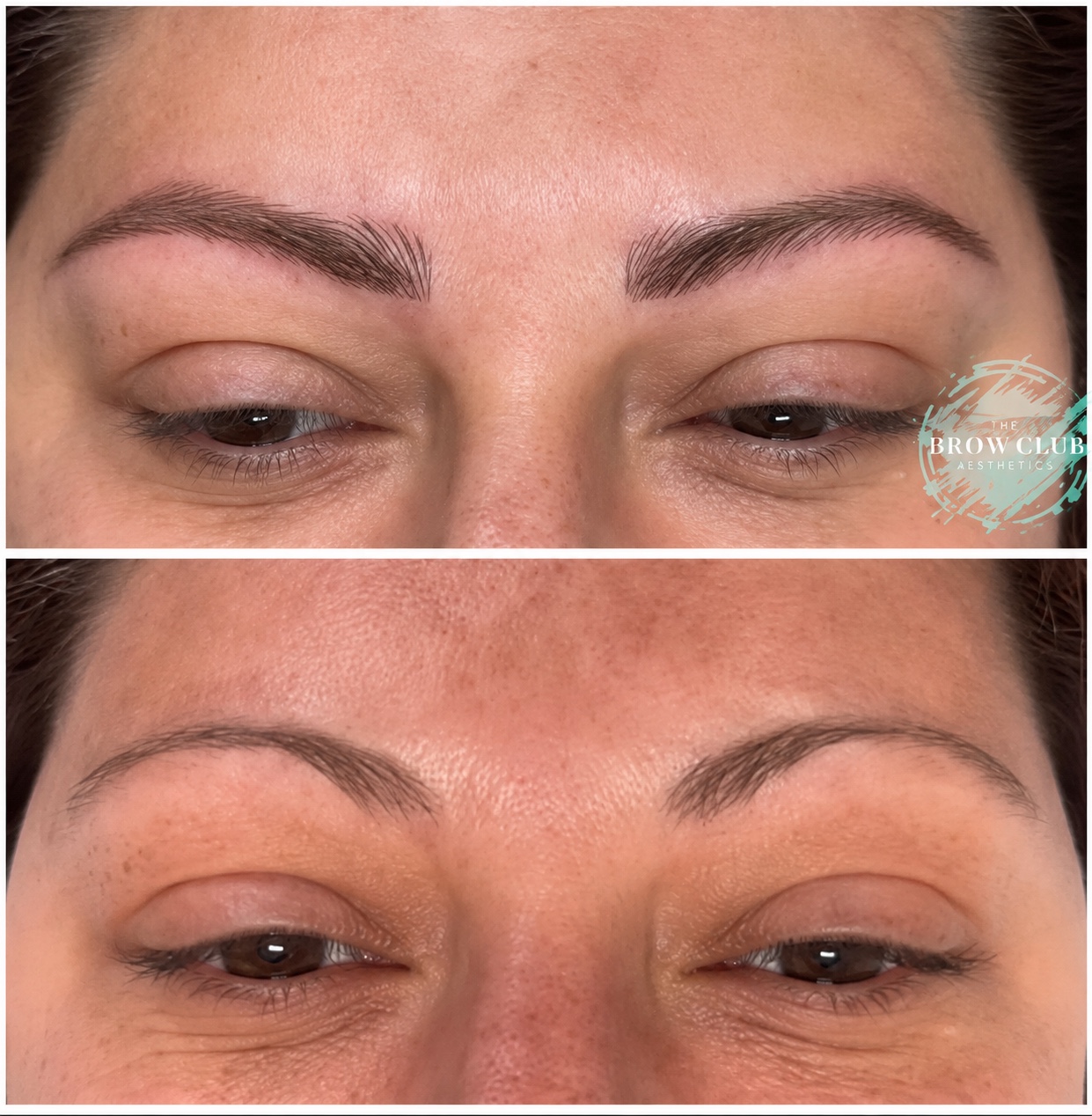 Brow treatment result