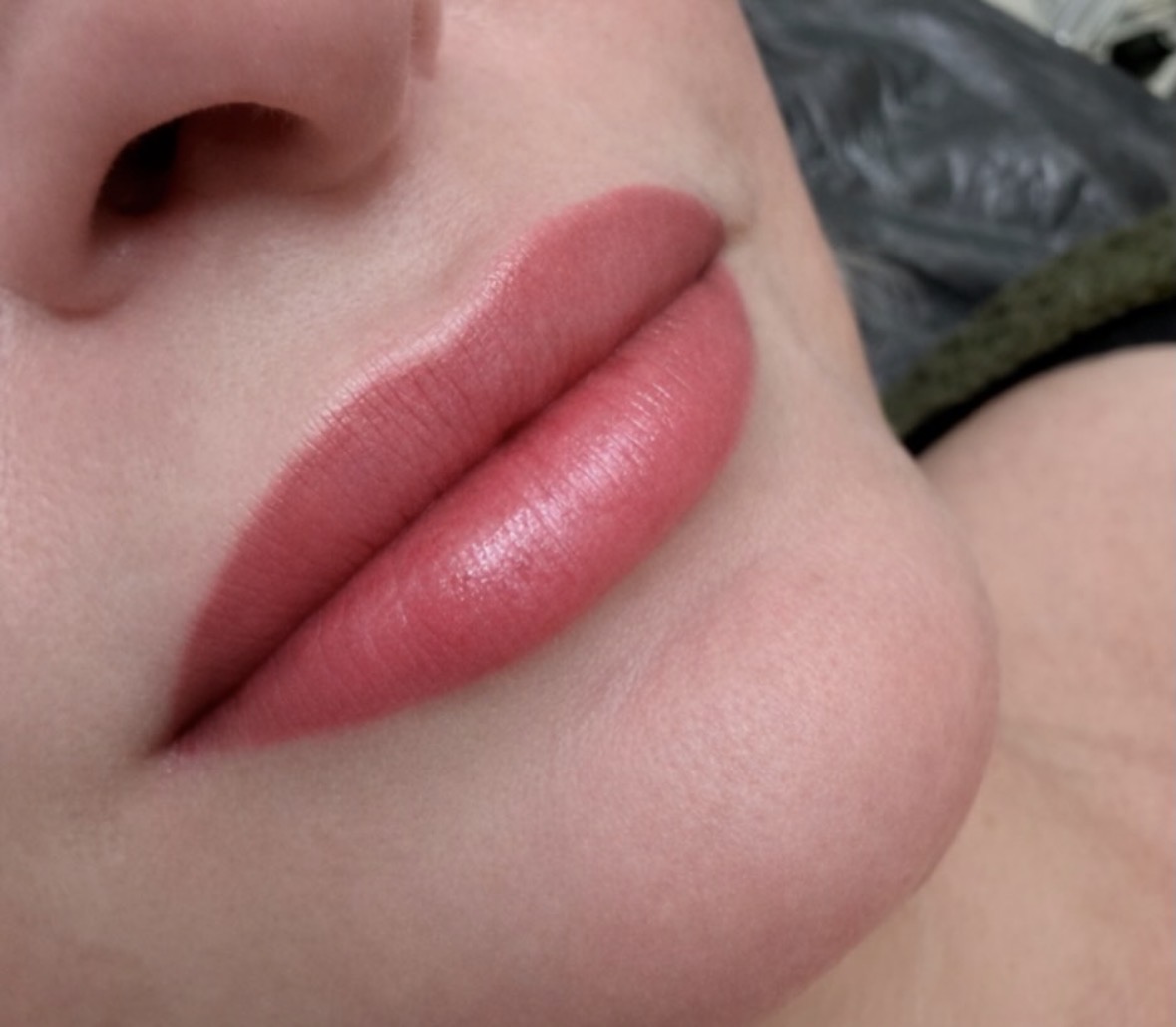 Brow treatment result